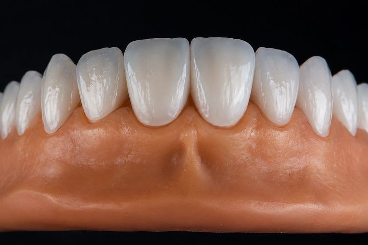 Estética dental na Implamix Odontologia