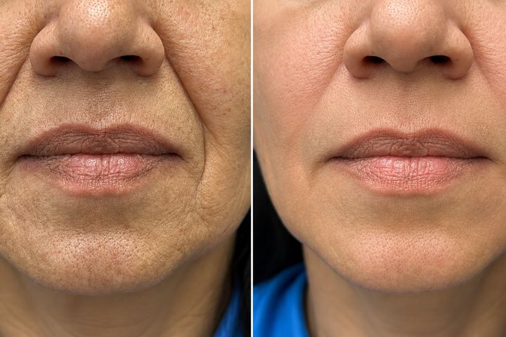 Harmonização facial na Implamix Odontologia